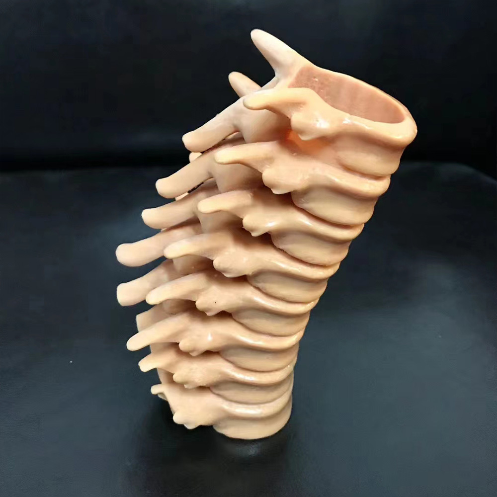 3D printed spine