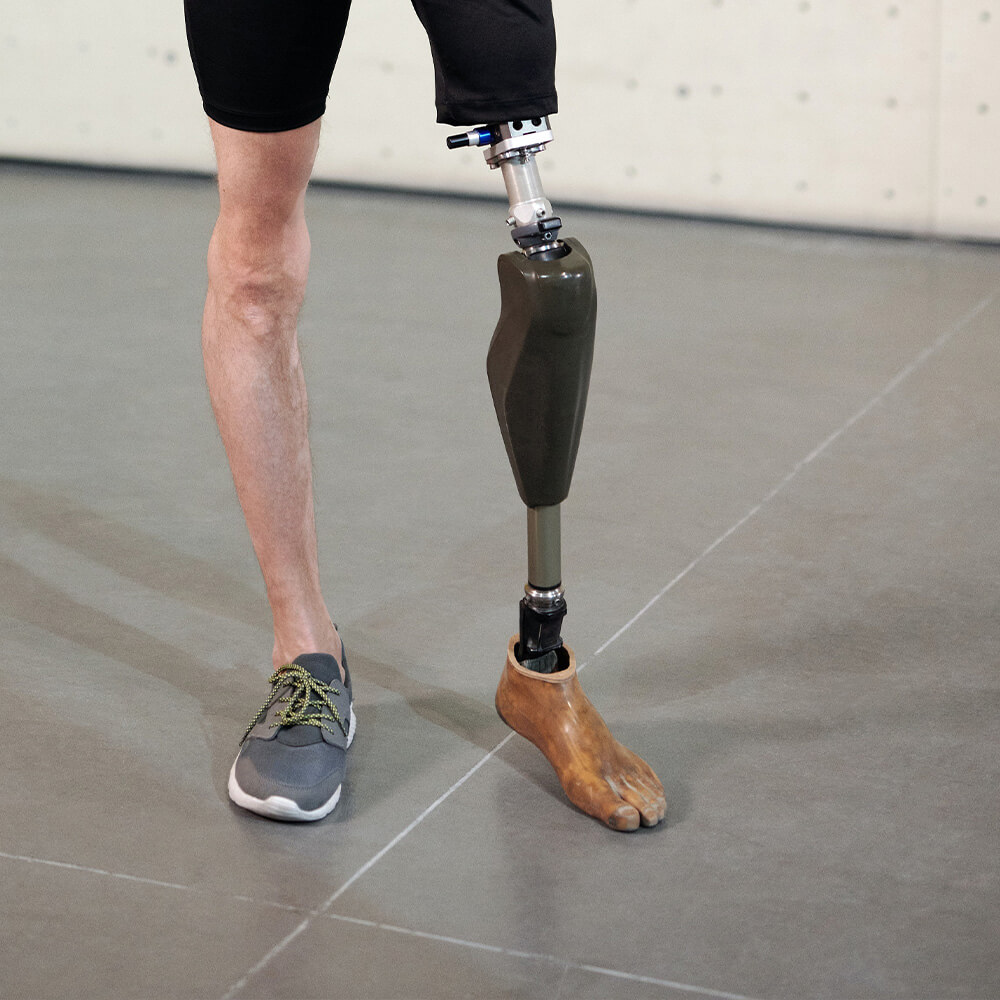 3D printed prosthetic foot