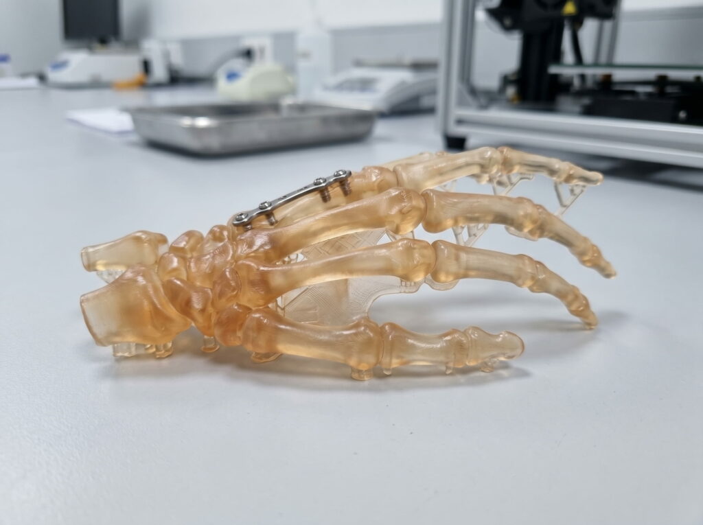 SLA 3D printed prosthetic hand