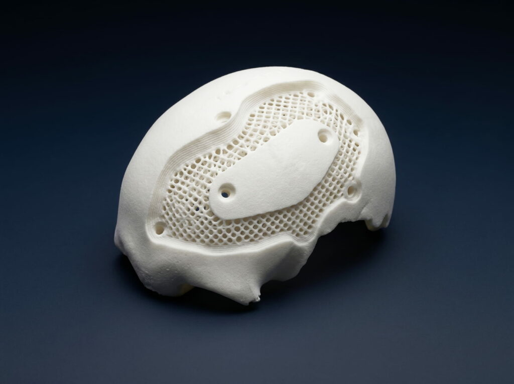 SLS 3D printed anatomical model